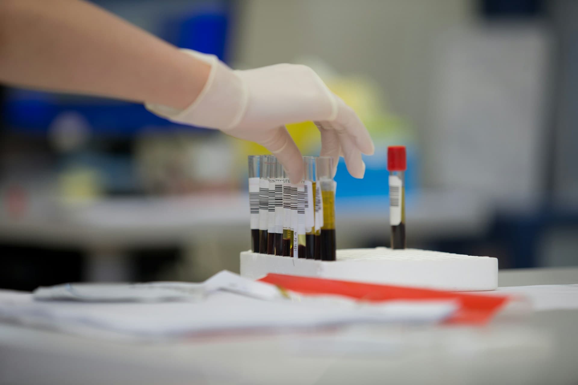 Lęk przed wynikami badań – jak poradzić sobie z niepewnością przed diagnozą